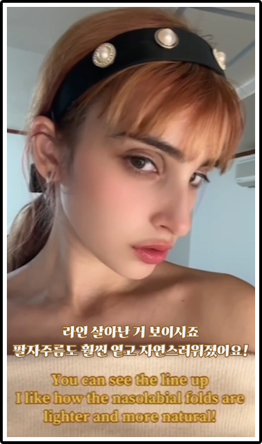 라인 살아난 거 보이시죠 팔자주름도 훨씬 옅고 자연스러워졌어요!