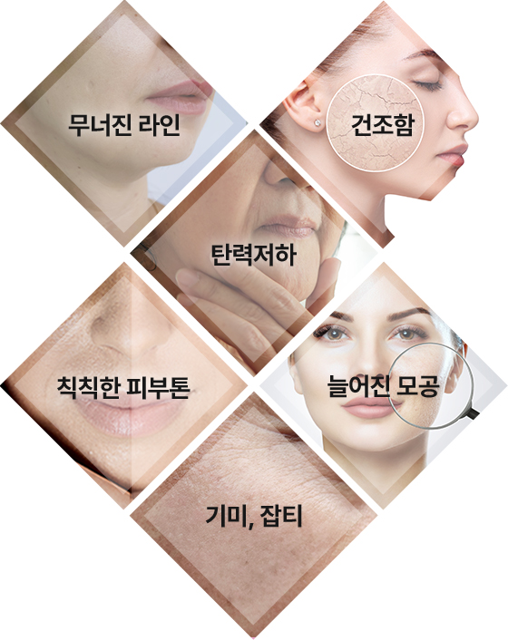 무너진라인 + 탄력저하 + 건조함 + 칙칙한 피부톤 + 기미,잡티 + 늘어진 모공